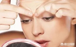 脸上如何祛痘？