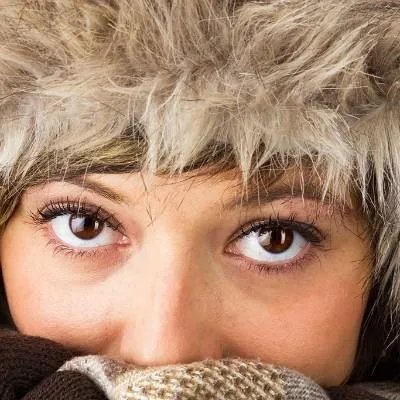 怎么去除黄褐斑