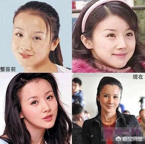 娱乐圈有哪些本来就长得很好看却还整容的明星？