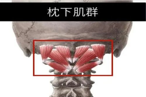枕下肌群位置图