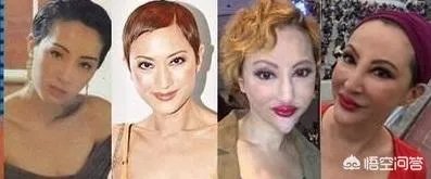 娱乐圈有哪些本来就长得很好看却还整容的明星？