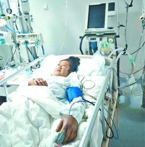 农妇遭马蜂蜇垂危家人正四处筹款  被大马蜂蛰了怎么处理