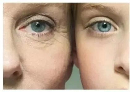 北京做美容除皱要多少钱