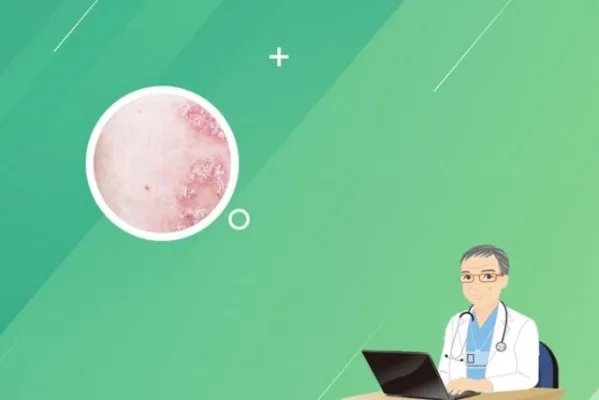 可善挺能保几年不复发