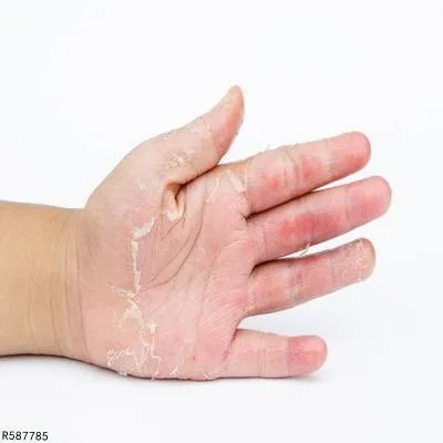 洪水接触皮肤会怎样