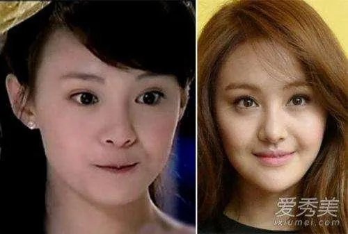 娱乐圈有哪些本来就长得很好看却还整容的明星？