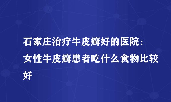 石家庄治疗牛皮癣好的医院：女性牛皮癣患者吃什么食物比较好