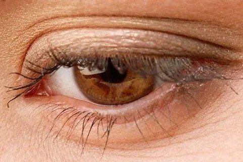 睫毛移植的注意事项